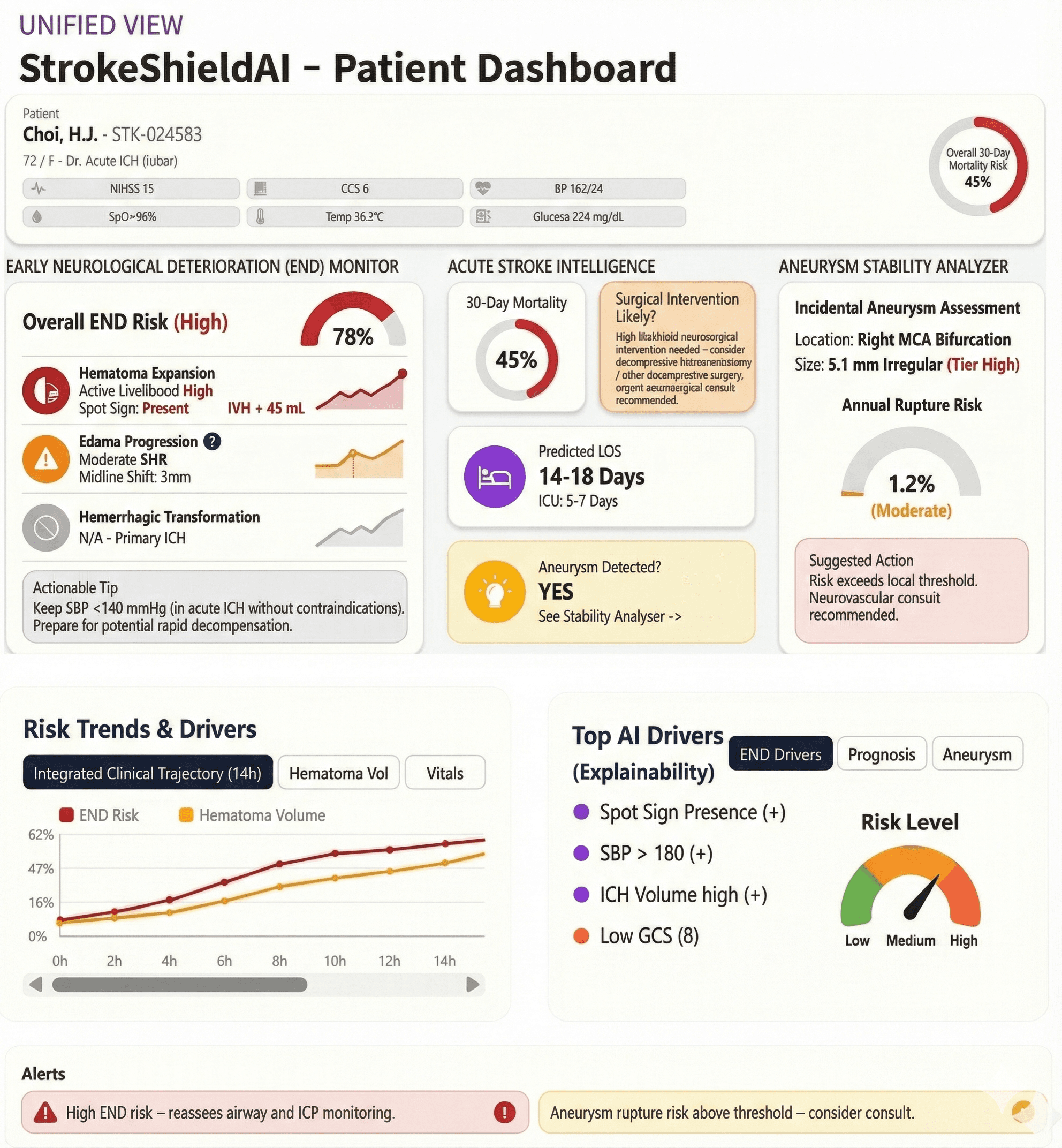 StrokeShieldAI Patient Dashboard Conceptual Rendering