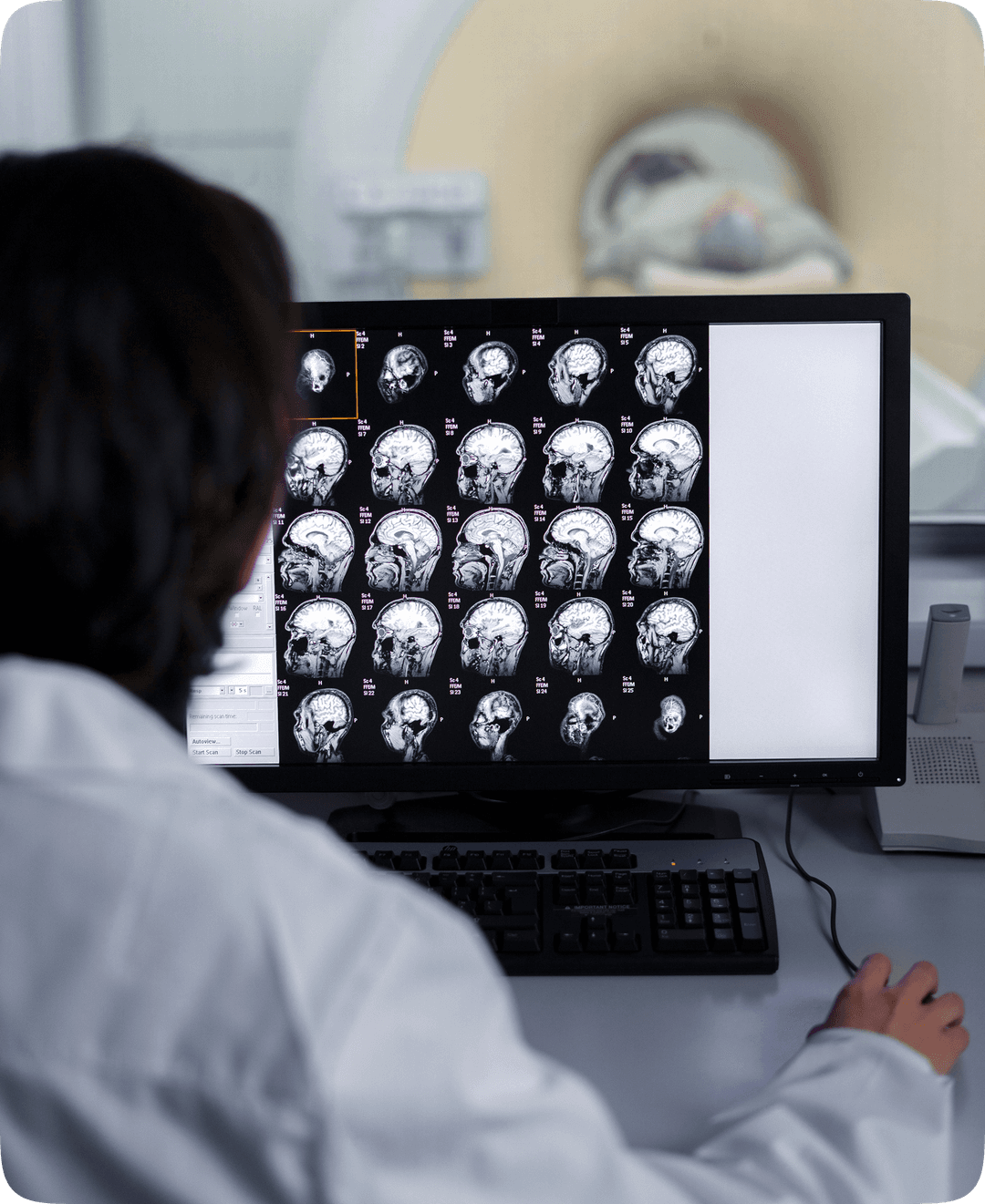 Doctor reviewing brain scans