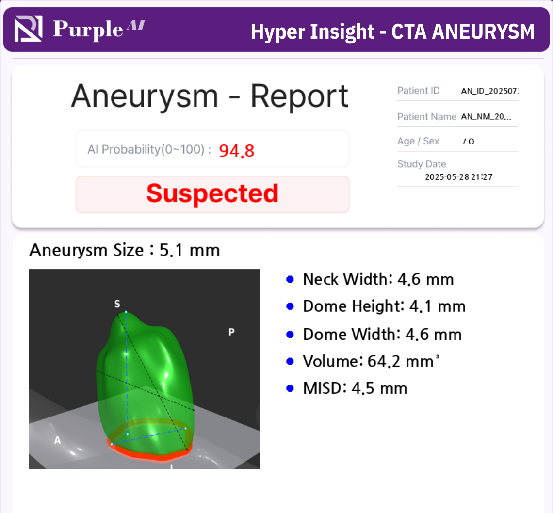 CTA Aneurysm 1
